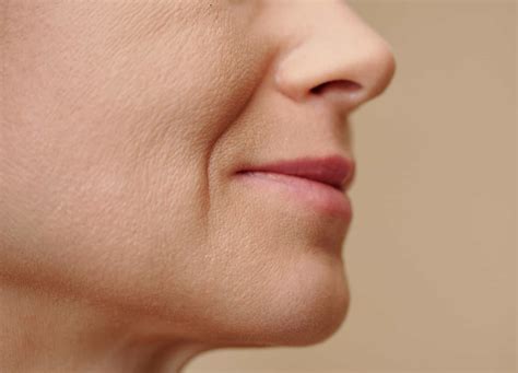 Marionette Lines Treating Marionette Lines Facial Acupuncture