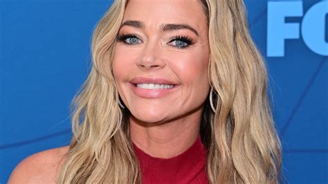 Denise Richards praised for transparent comments about new facelift