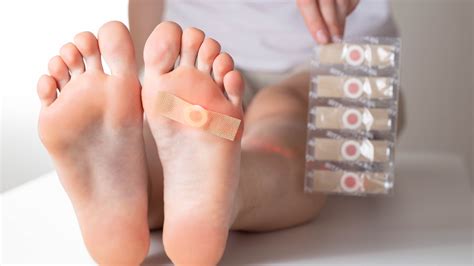 Plantar Wart Treatment | Ankle & Foot Centers of America