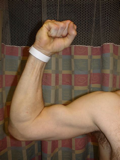 Why Do My Arms Feel So Weak And Heavy at Saul Carroll blog