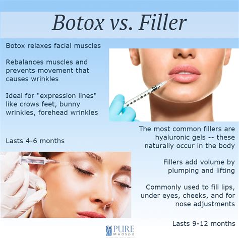 The quest for the perfect injectable botox vs dermal fillers – Artofit