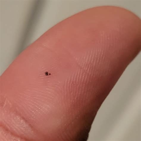 Pictures of my mole with and without mole scan app (the first one is with app). Does it look ...