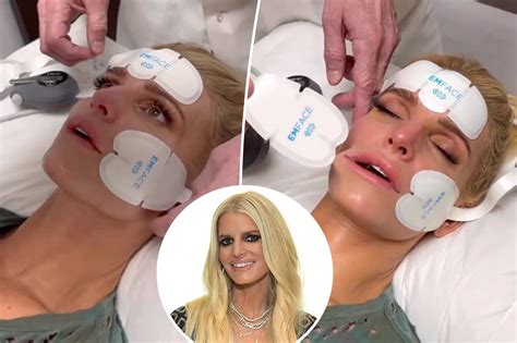 All about Emface, Jessica Simpson's 'needle-free facelift' treatment