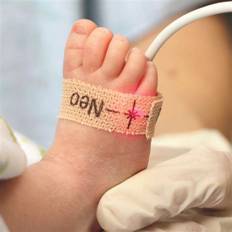 Infant Pulse Oximeter Adhesive Sensor at Joseph Shupe blog