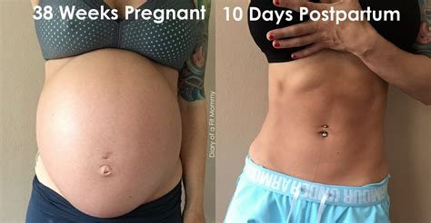 Before And After Pregnancy Belly