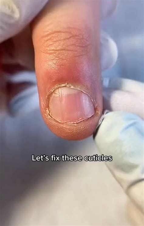 how to care nails | How to grow nails, Nail growth tips, Nail care