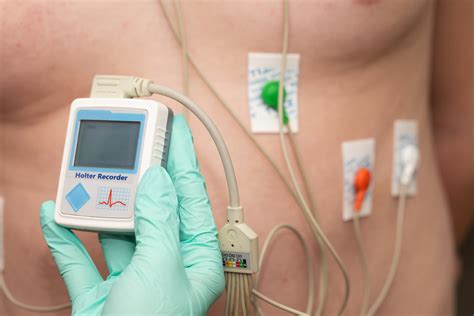 Cardiac Monitoring