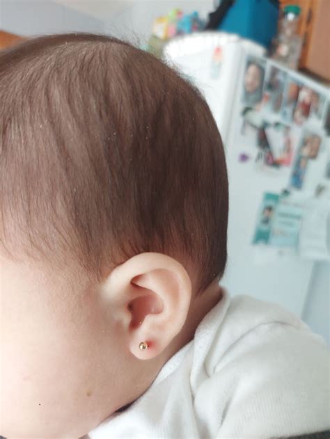 Infected Baby Ear Piercing Ear Piercing Guide: Piercings Types And
