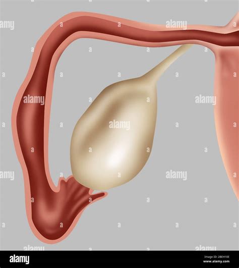 Fallopian tube hi-res stock photography and images - Alamy