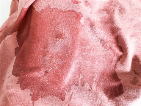 How to Remove Blood From Clothing : 3 Steps (with Pictures) - Instructables