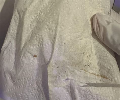Discharge After Colposcopy And Biopsy