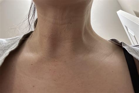 Loose, wrinkly skin on my neck. How do I get rid of it? : r/30PlusSkinCare