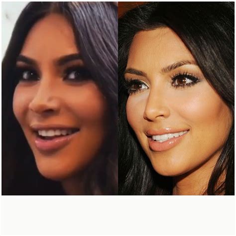 Kim Kardashian's Journey: From Natural Beauty To Global Icon