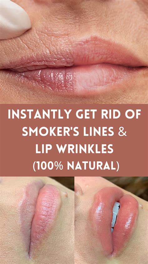 Before You Try Lip Fillers… Try This | How to fill in fine lines on ...