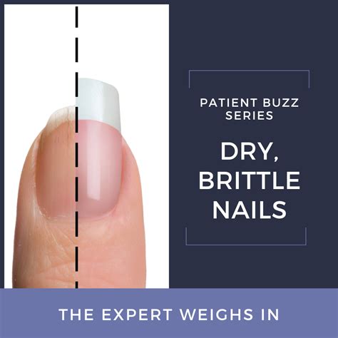 Lichen Planus Nails