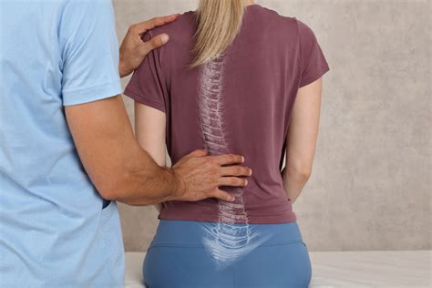 Four Common Types of Scoliosis - Atlanta Brain and Spine Care