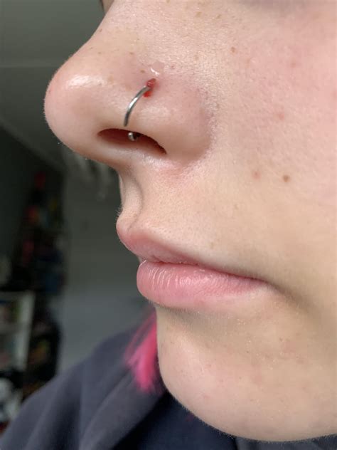 My nose is infected, should I take out the piercing? I’ve had my nostril pierced for 3 years and ...