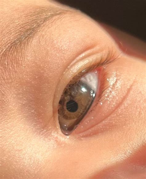 What color will her eyes be?? Eye color progression | BabyCenter