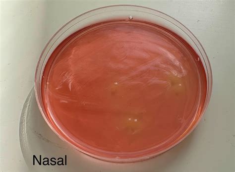 Msa Agar Plates