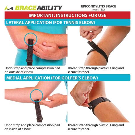 Medial Vs Lateral Epicondylitis