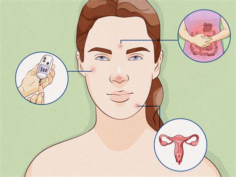 Does a Nose Pimple Mean Someone Likes You? Truths & Myths