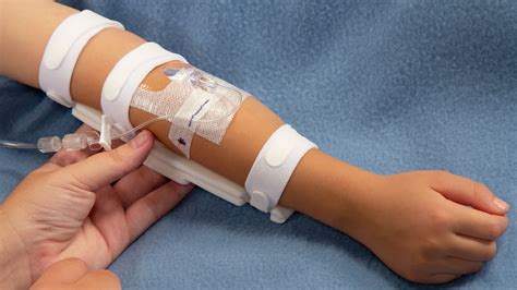 Iv Infiltration Signs