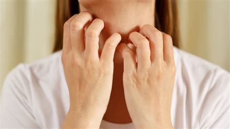 ¿Qué es el eccema? Síntomas y causas - Pompeia Life