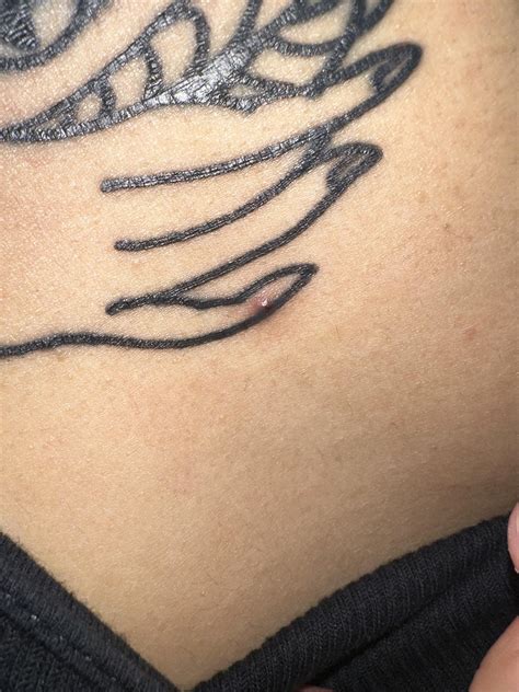 Pimple popped in the shower fml : r/tattooadvice