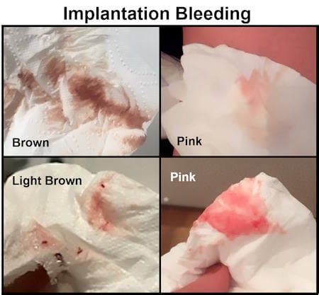 Implantation Bleeding: When It Happens, How Long It Lasts & What It ...