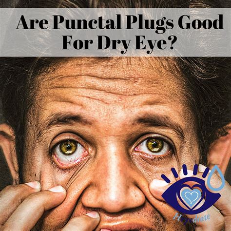 Punctal Plugs For Dry Eye – Eye Love