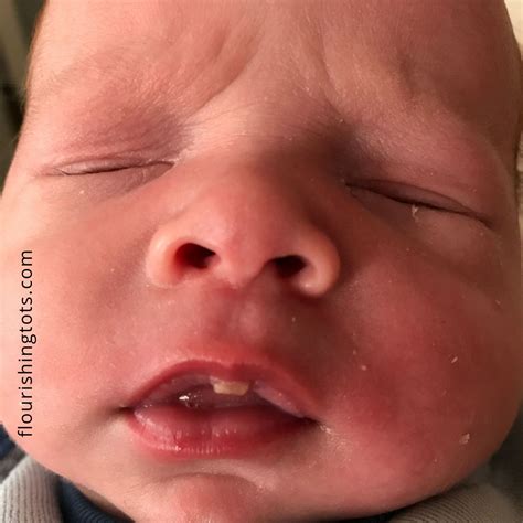 Why Does My Baby Pursed His Lips | Lipstutorial.org