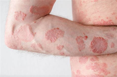 Dermatology – Chatham Skin Clinic