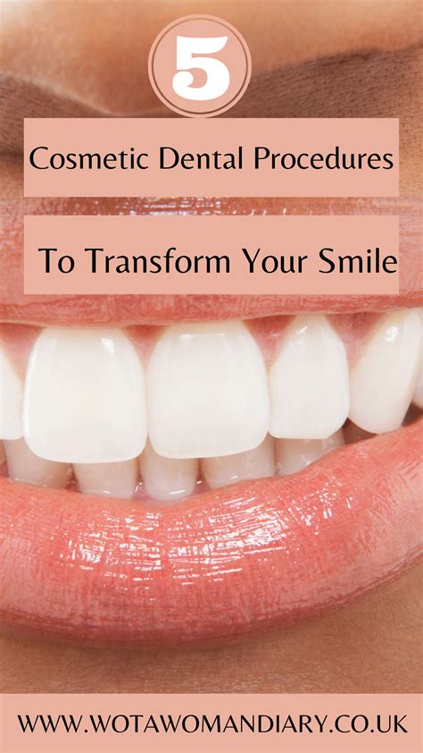 Cosmetic dental procedures – Artofit