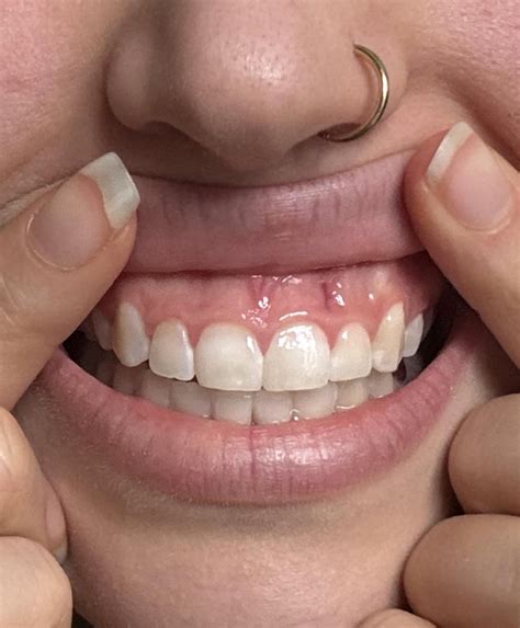 What is this purple line on my gums?? : r/askdentists