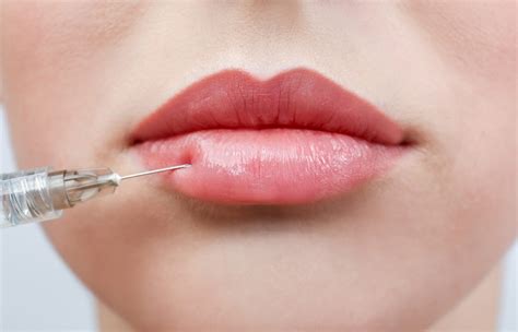 Lip Injections In Houston at Nancy Milne blog