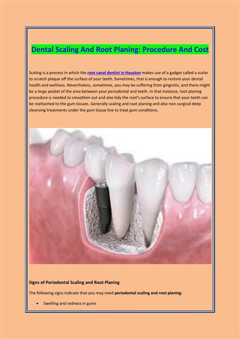 PPT - DENTAL SCALING AND ROOT PLANING PROCEDURE AND COST PowerPoint Presentation - ID:9257405
