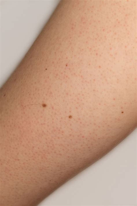 8 Common Skin Problems and How to Fix Them | Black dots on face, Nail problems, Black dots on skin