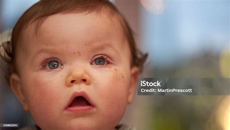 Conjunctivitis Or Pink Eye Stock Photo - Download Image Now - Child ...