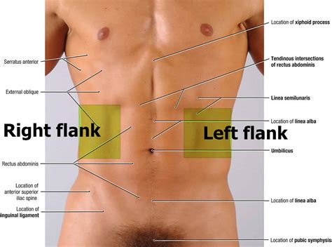 Flank Pain Location