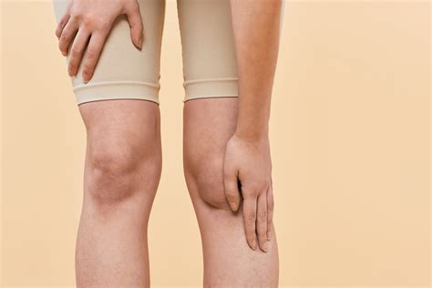 Knock Knees (Genu Valgum) in Children and Adults