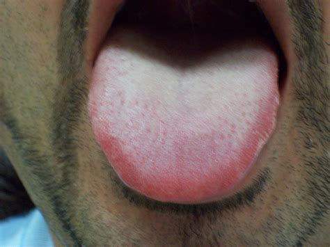 Look at your tongue, check your health