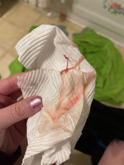 Is Bleeding Normal After Cervix Check at Rory Love blog