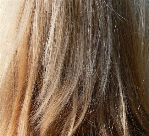 Hair Transplant Costs in Turkey vs. USA – What’s the Difference? - Hair Transplant Clinics ...