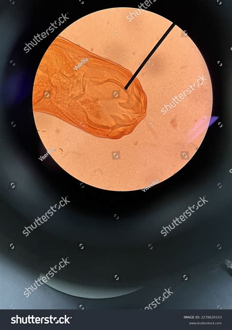 Ancylostoma Duodenale Mouth Worm Parasite Biology Stock Photo ...