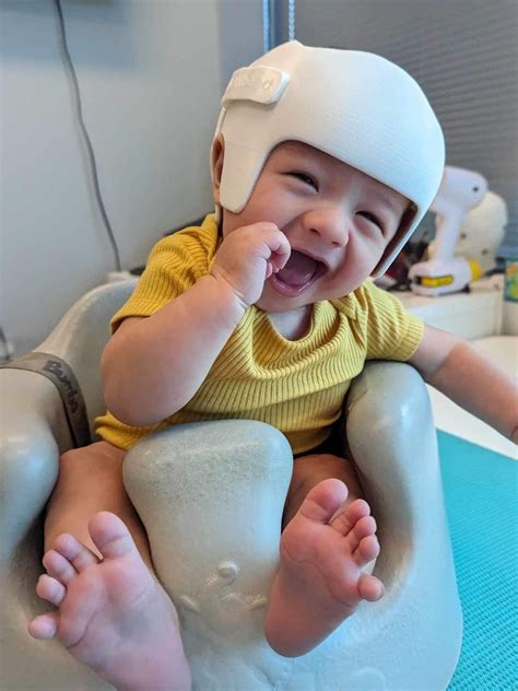 Everything You Need To Know About Head Shape Helmets and Flat Head Syndrome Prevention For Your ...