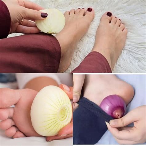 Try The Unexpected Health Benefits Of Onions On Your Feet