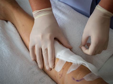 4 Types of Wound Drainage: Serous, Sanguineous & More