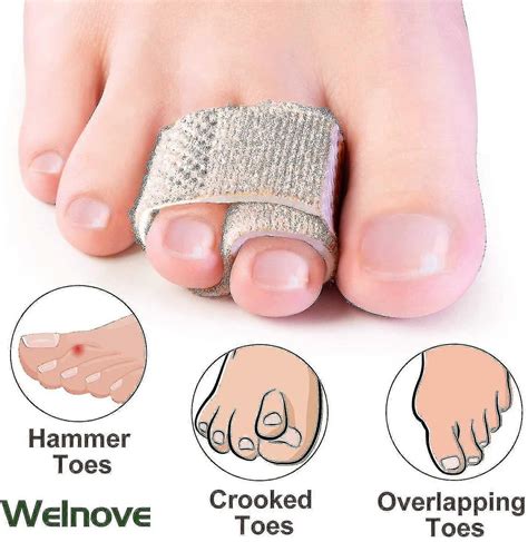 6-pack Of Hammer Toe Straighteners For Straightening Hammer Toes, Broken Toes, Crooked Toes And ...