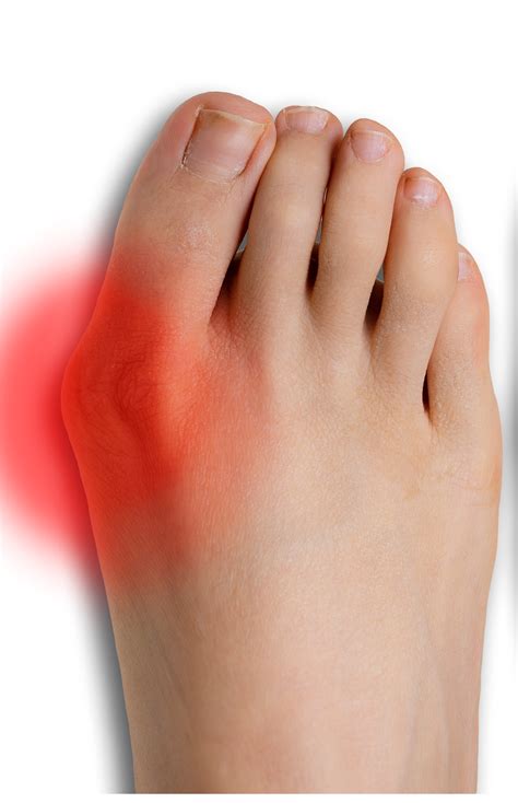 Pain In Foot By Big Toe Joint at Ralph Halladay blog