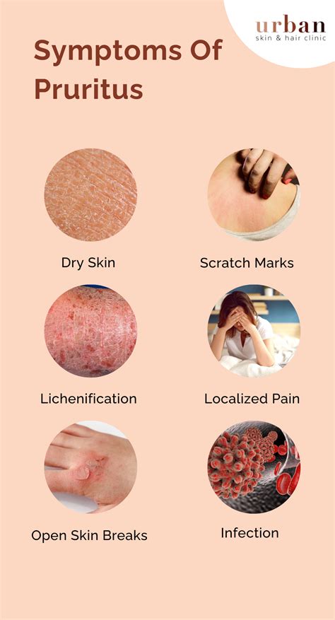 Pruritus Types, Causes, Symptoms & Treatment | USHC